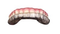 Mouthguard