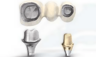 Abutment & Bridge