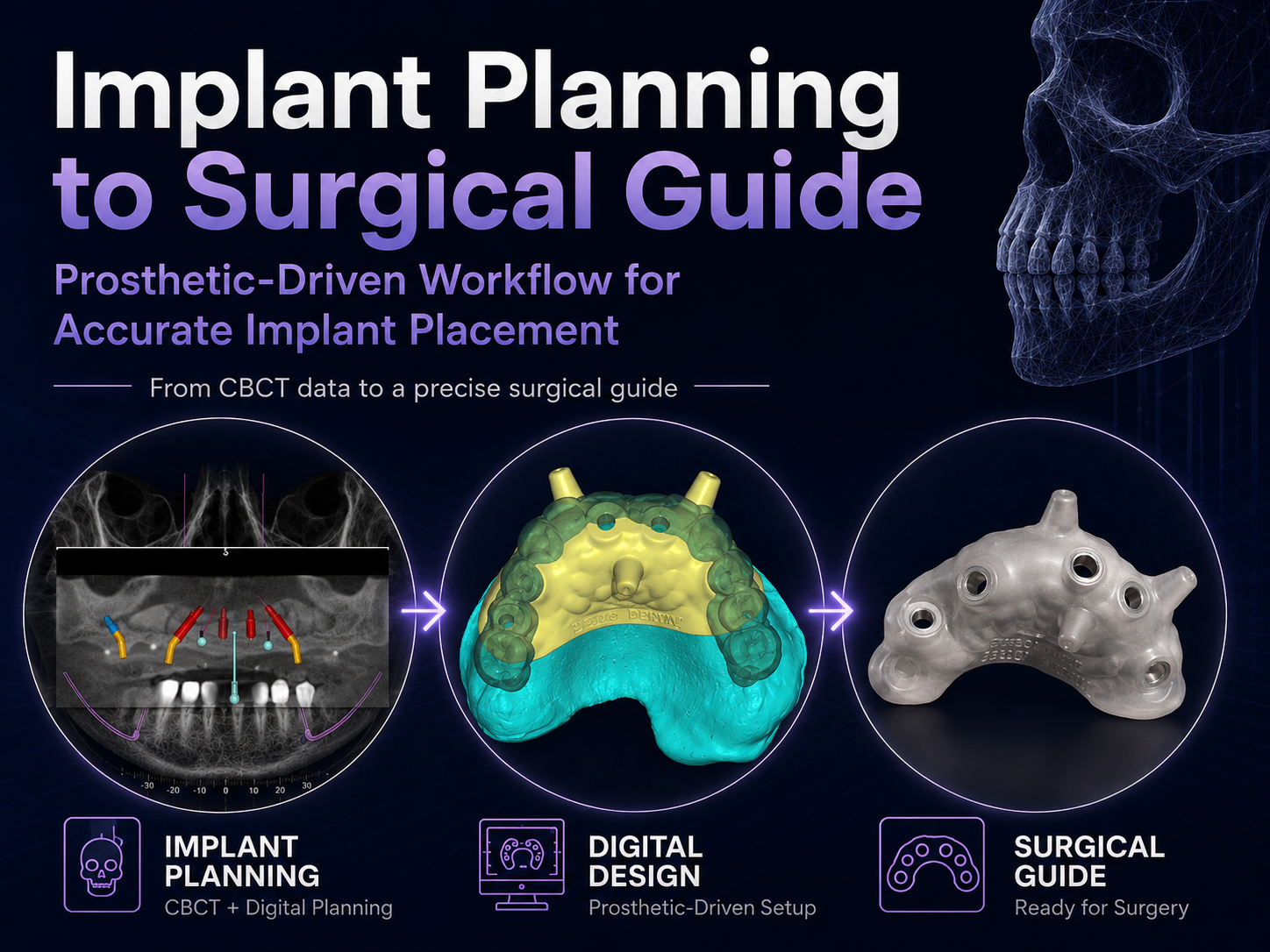 Implant Planning / Surgical Guide RX